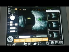 IOL 전자 계산 기능 초음파 스캐너 기계 10MHz 높은 최고 축 방향 해상도