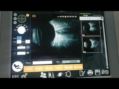 비 초음파 스캐너 기계 전자기 유리체 병진단