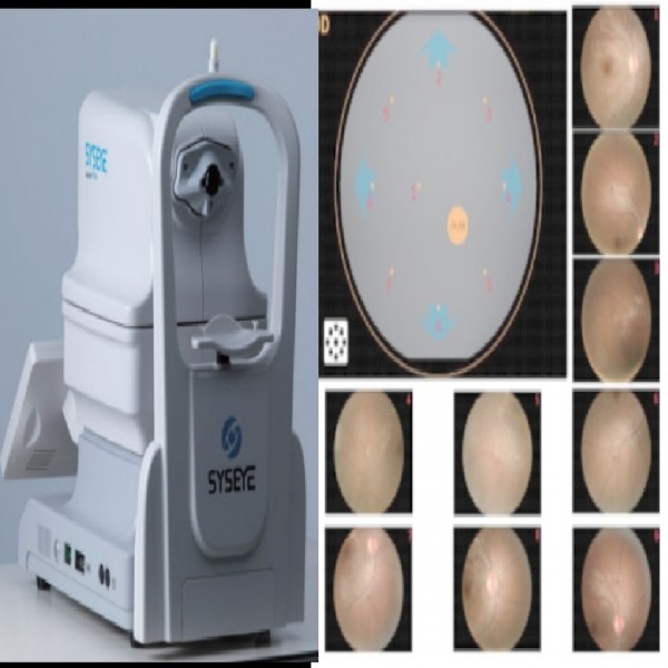 휴대용 비 미드리아틱 망막 카메라 2.8mm 학생 DICOM & AI 수동 초점