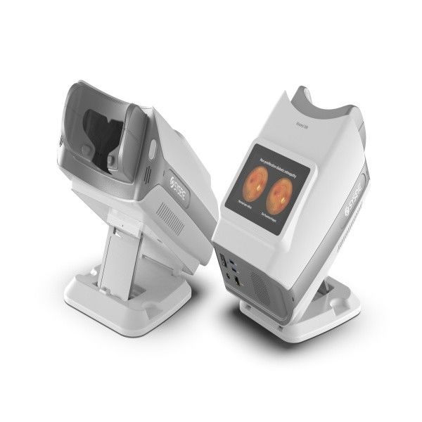 레티나 스크리닝을 위한 50° 시야장 (Kestrel 300) 을 가진 휴대용 비 미드리아틱 디지털 펀더스 카메라