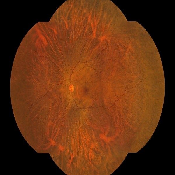 광범위한 시야장 176°와 해상도 LED True Color Imaging 기술